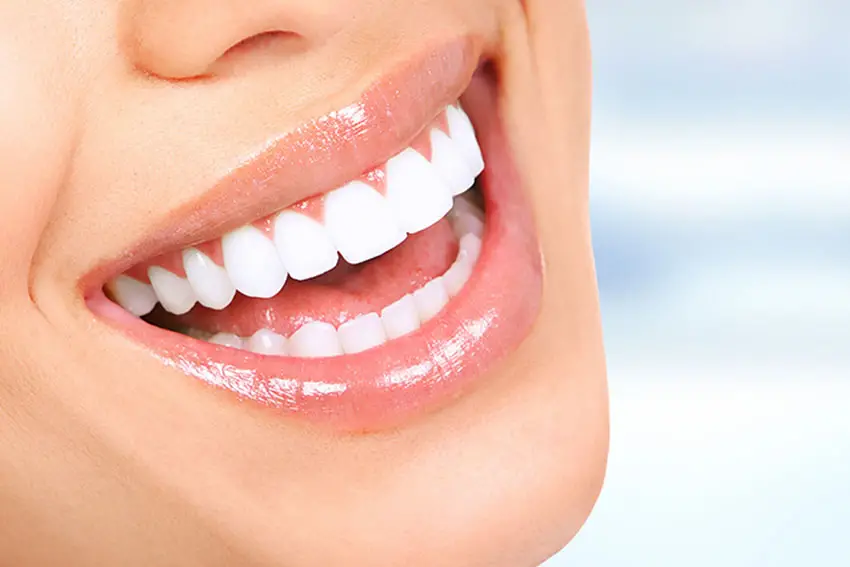 Чому не слід проводити відбілювання зубів самостійно