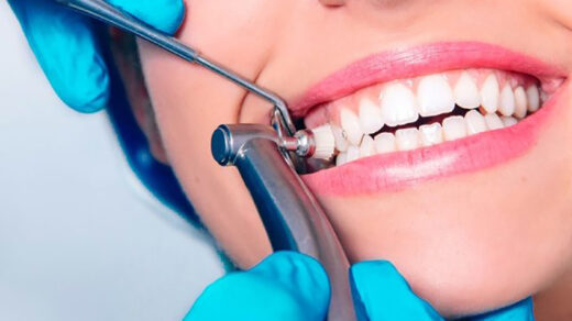 Як обрати свого стоматолога: ключові кроки до здорових посмішок